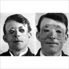 plastic surgery