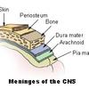 Meningitis
