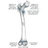 bone disease