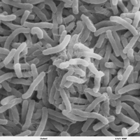 Cholera