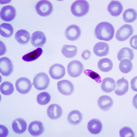 malaria
