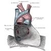 Pericarditis