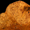Liver cancer