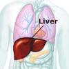 Liver transplantation